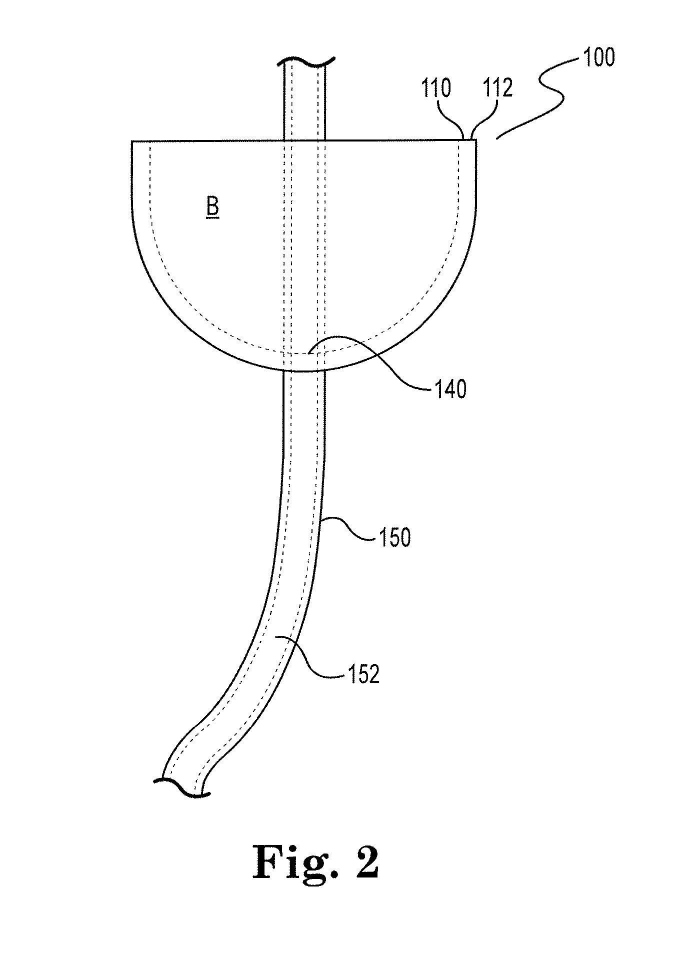 Device and method for illumination of vaginal fornix with ureter location, isolation and protection during hysterectomy procedure