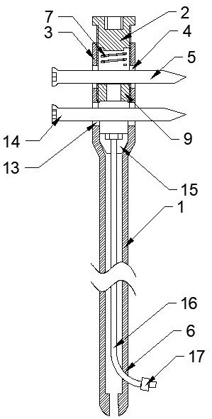 Novel adjustable intramedullary nail