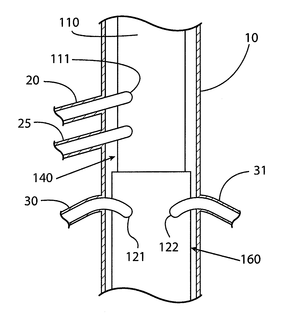 Method and apparatus for endovascular therapy of aortic pathology