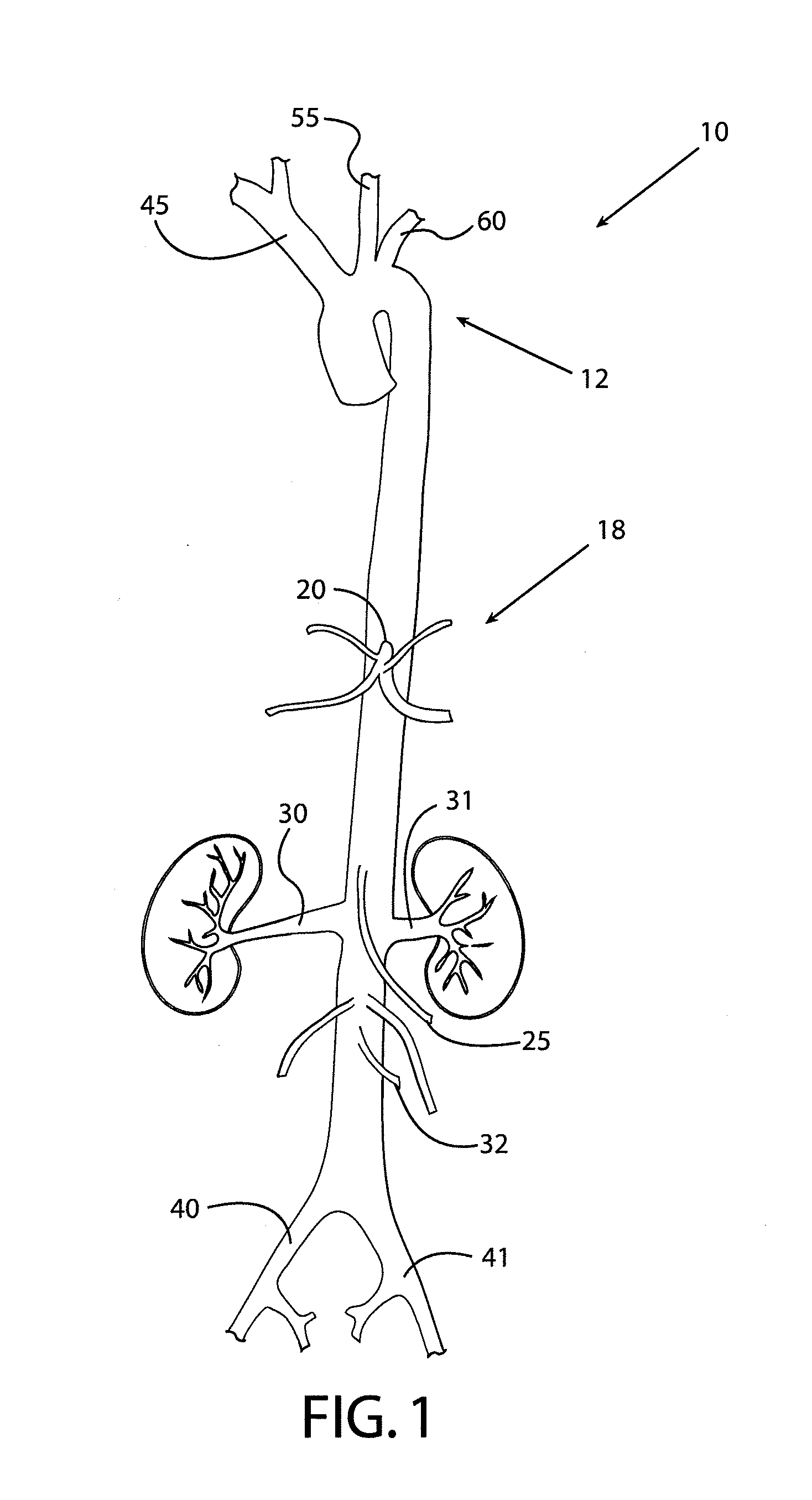 Method and apparatus for endovascular therapy of aortic pathology