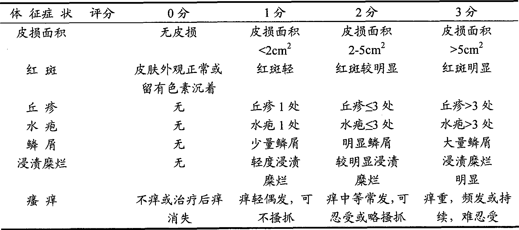 Liranaftate cream preparation method