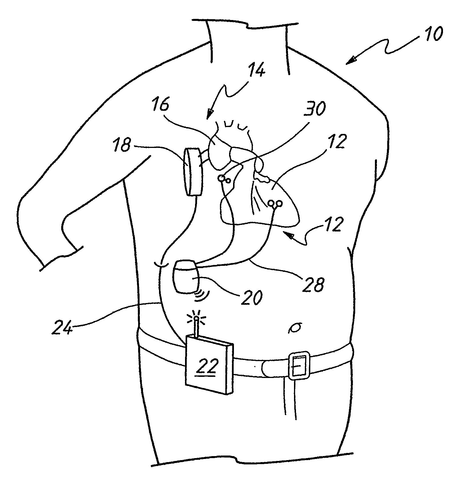 Synchronization control system