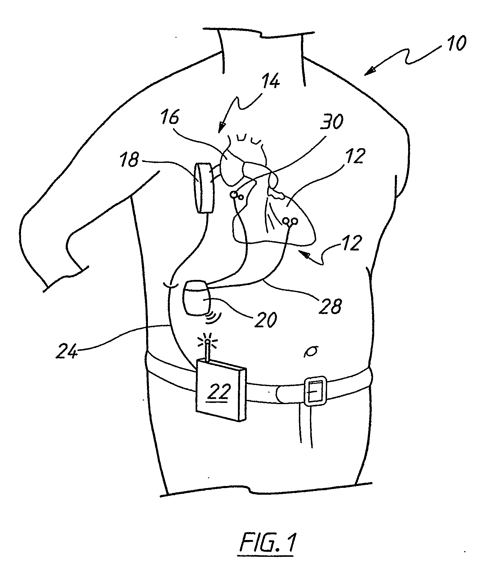 Synchronization control system