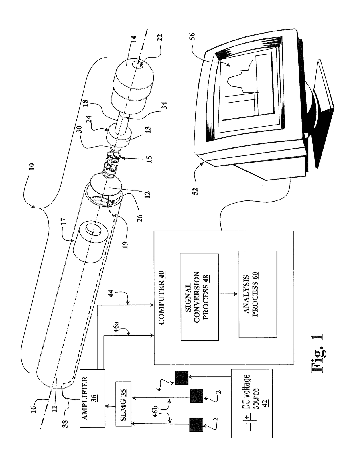 Diagnosis of brain and spinal cord injury by bulbocavernosus reflex measurement