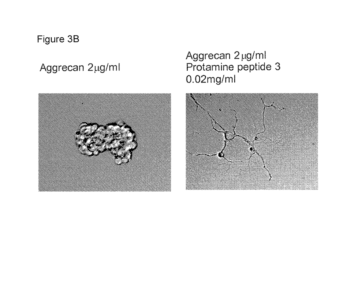 Protamine in treatment of neuronal injuries