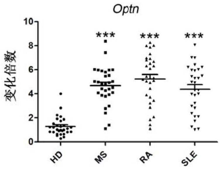 Application of targeting optineurin in the preparation of drugs for the prevention and treatment of autoimmune diseases