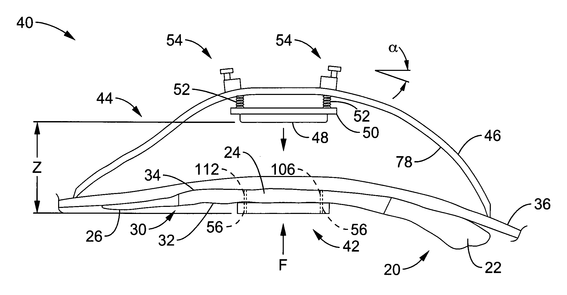 Apparatus and methods for magnetic alteration of deformities