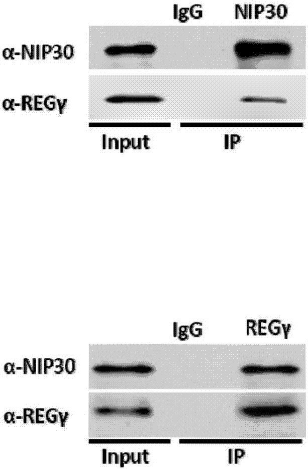 Polypeptide inhibitor for REG gamma-20S proteasome and applications thereof