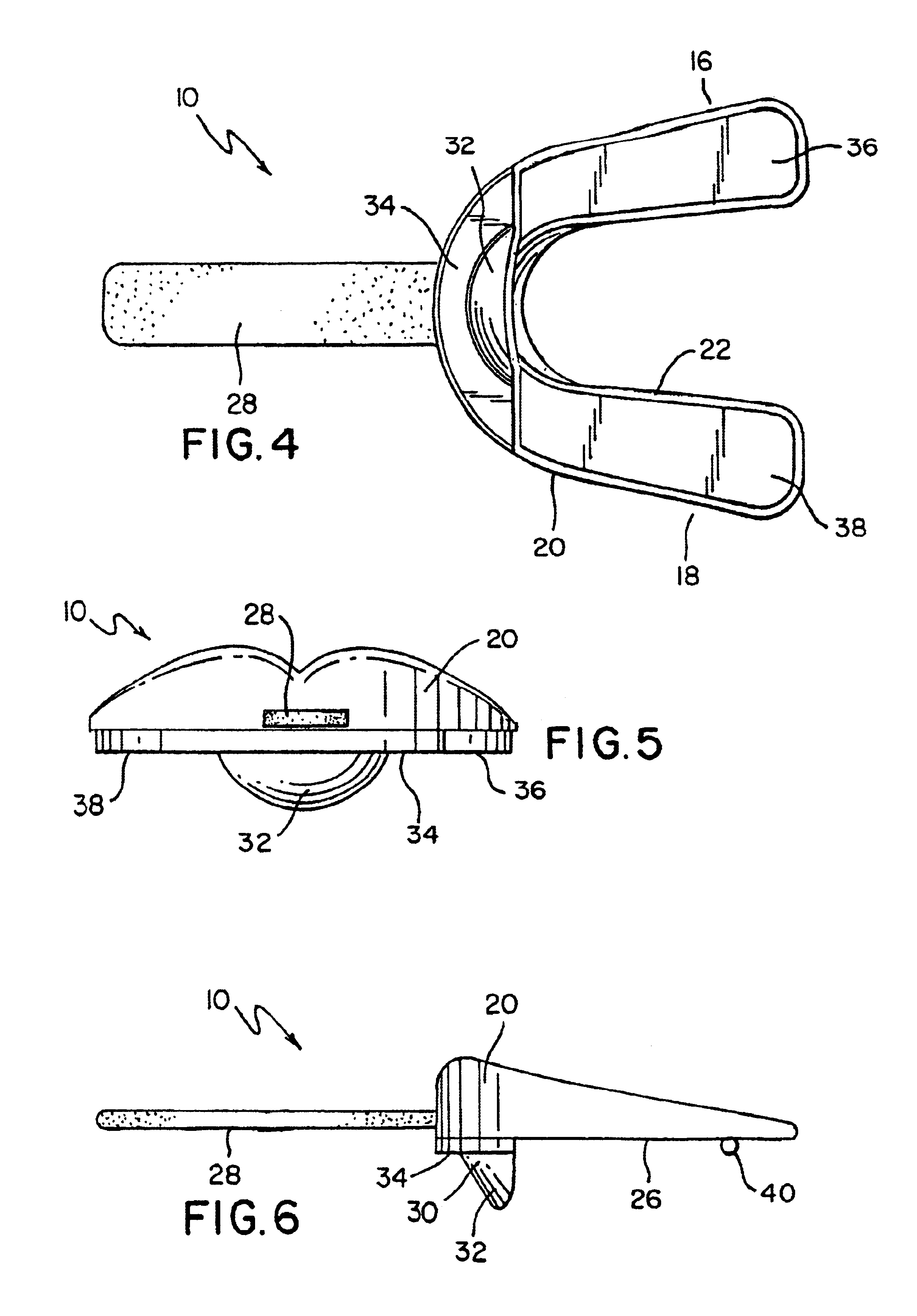 Custom tray for reducing dental clenching