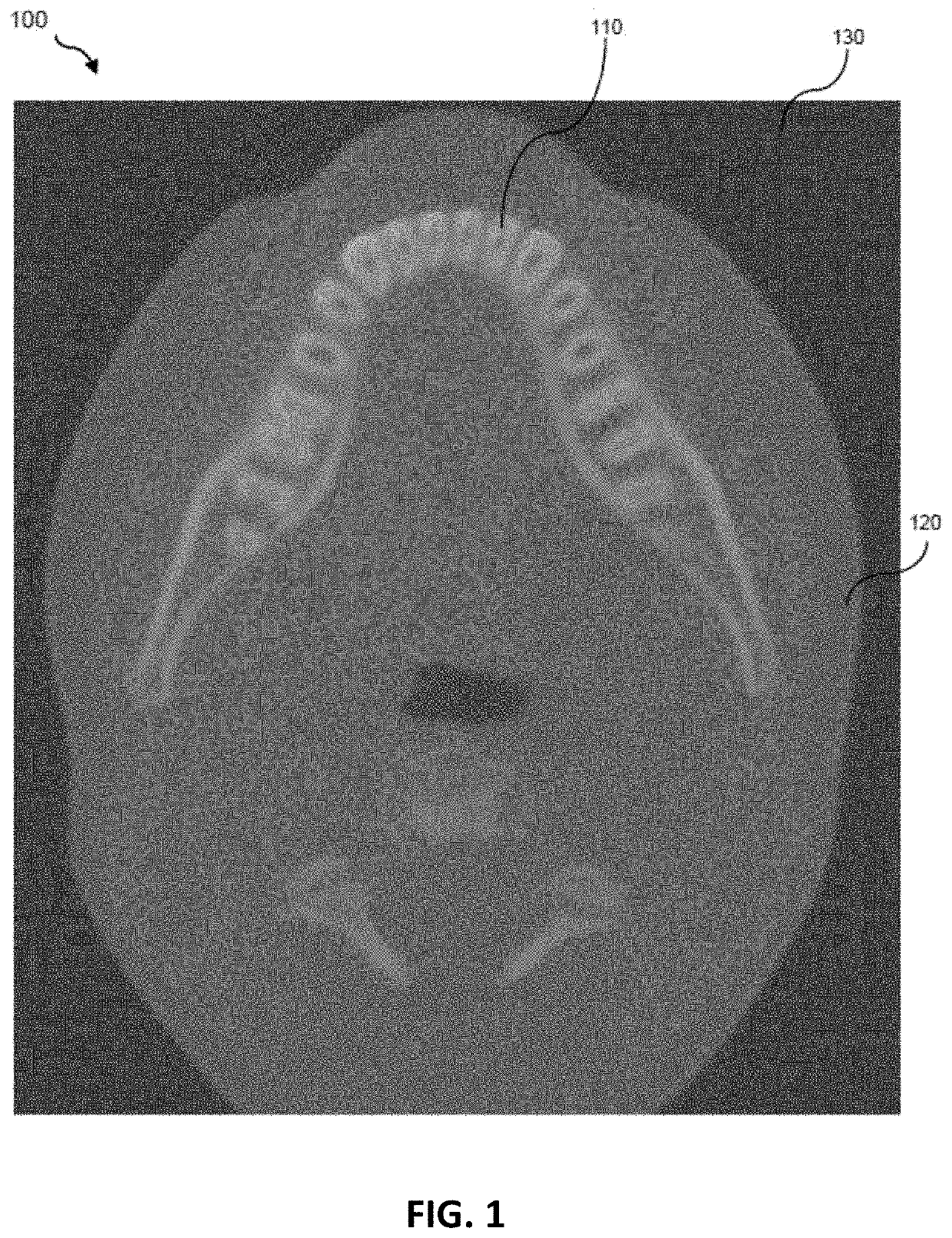 Medical imaging data compression and extraction on client side