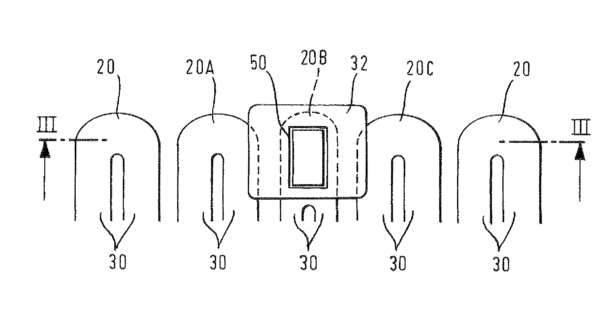 Stenting ring with marker