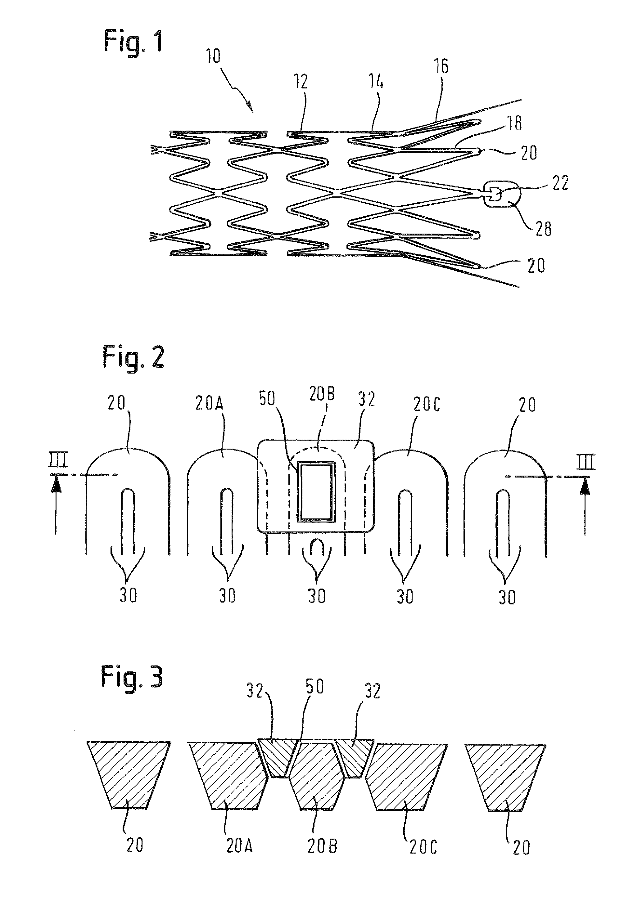 Stenting ring with marker