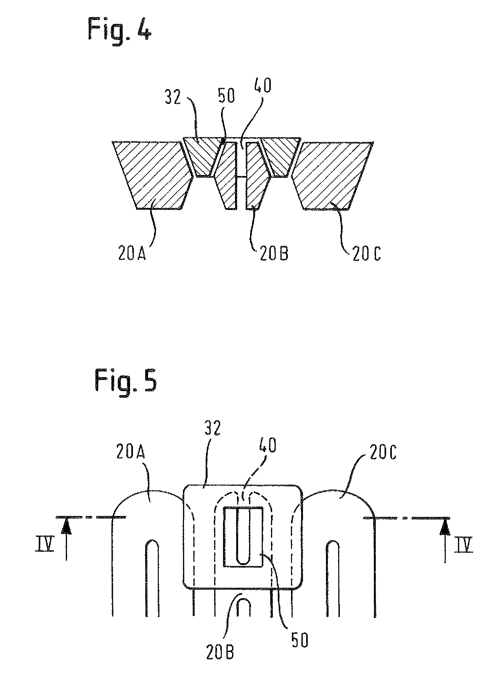 Stenting ring with marker