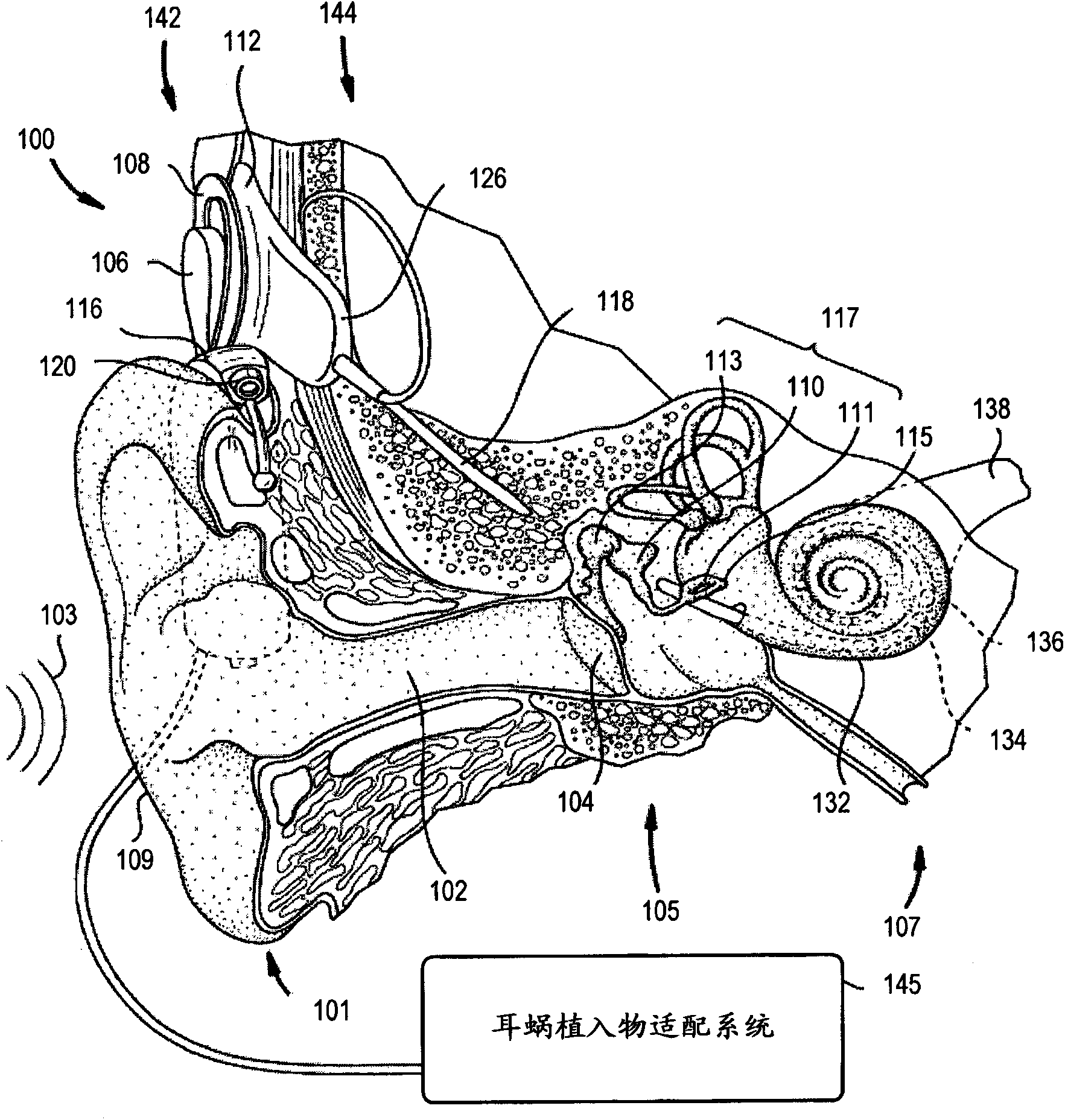 System and method for detecting nerve stimulation with an implanted prosthesis