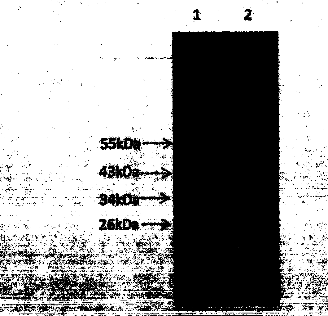 Humanized antibody for resisting severe fever with thrombocytopenia syndrome bunyavirus (SFTSV)