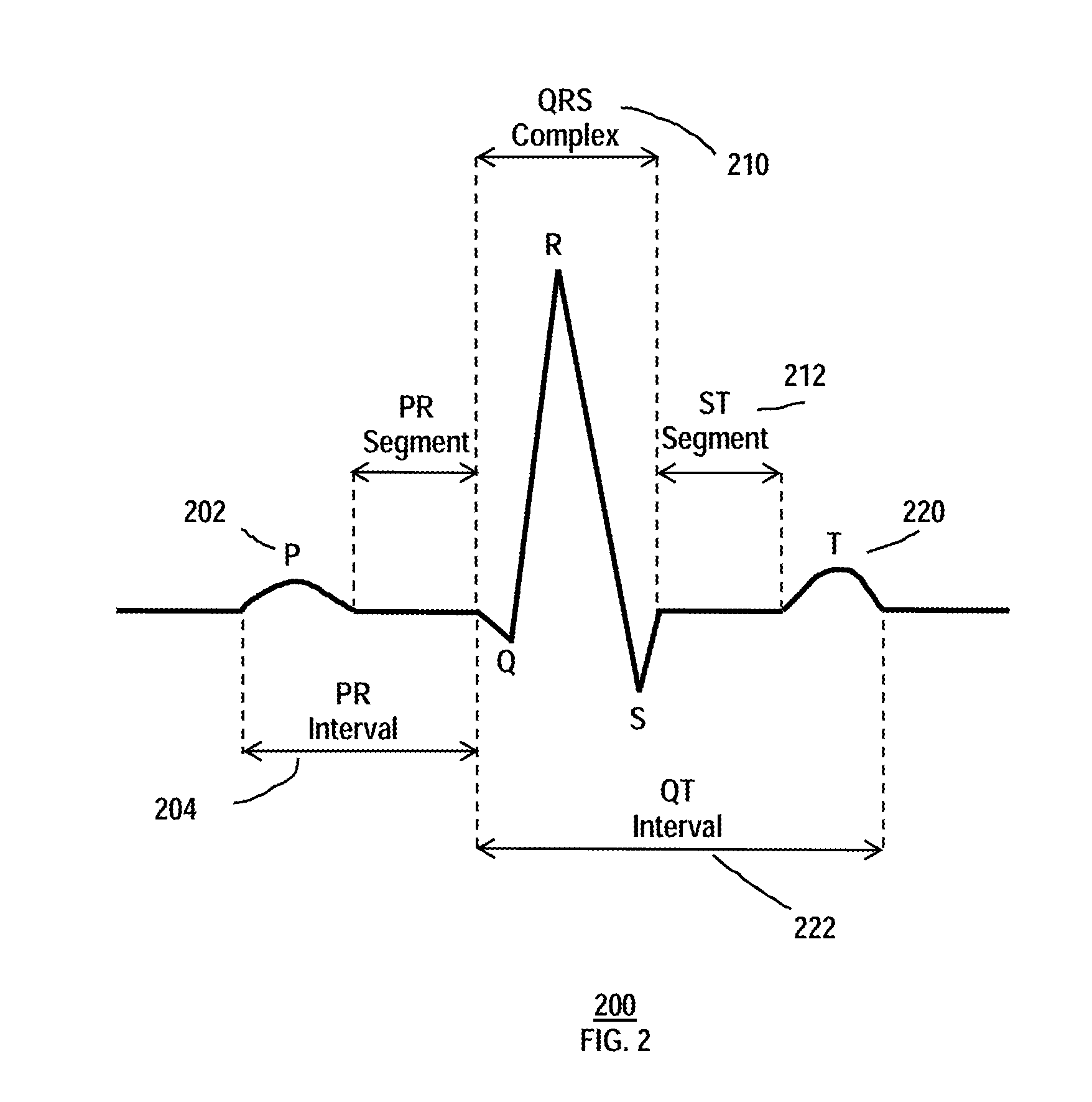 Seamlessly embedded heart rate monitor