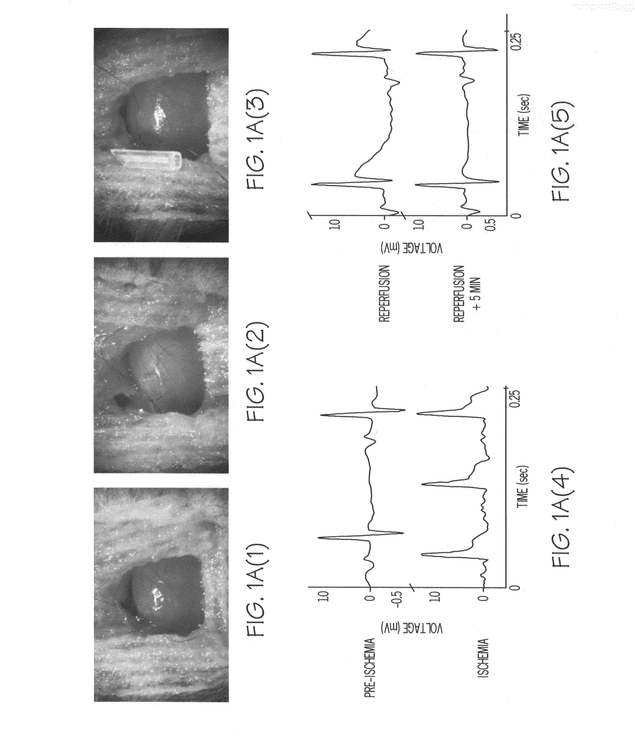 Methods of preventing ischemic injury using peripheral nociceptive stimulation