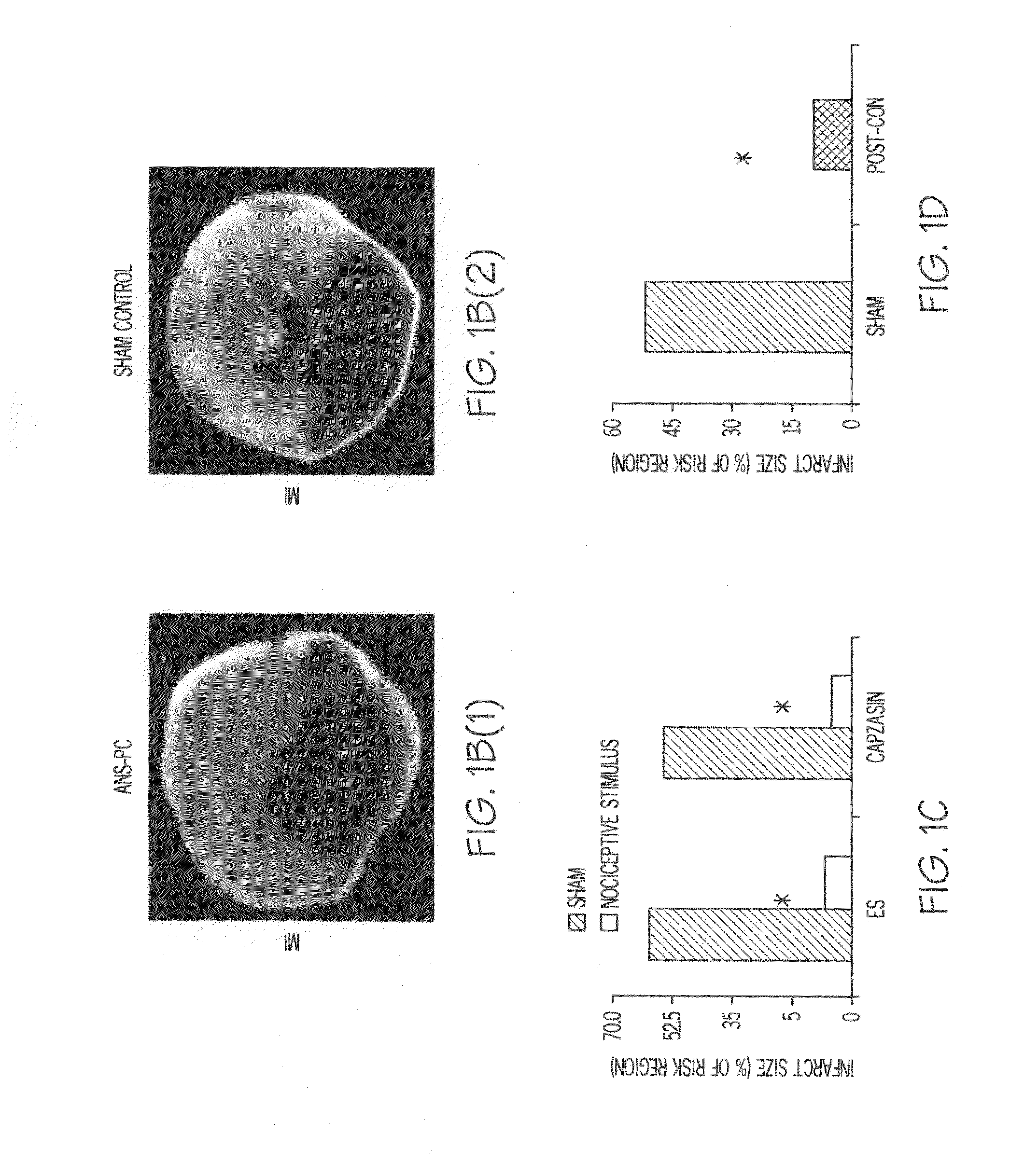 Methods of preventing ischemic injury using peripheral nociceptive stimulation