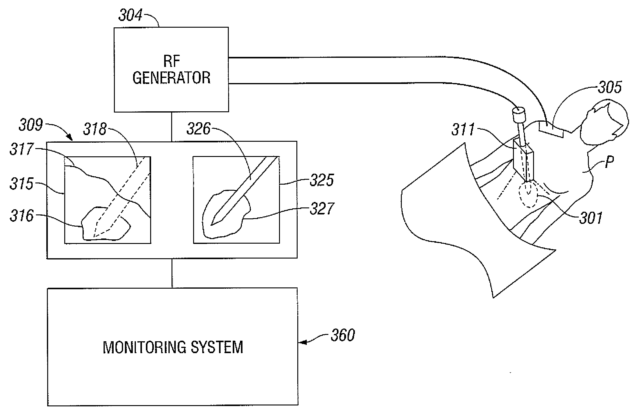 Method for Volume Determination and Geometric Reconstruction