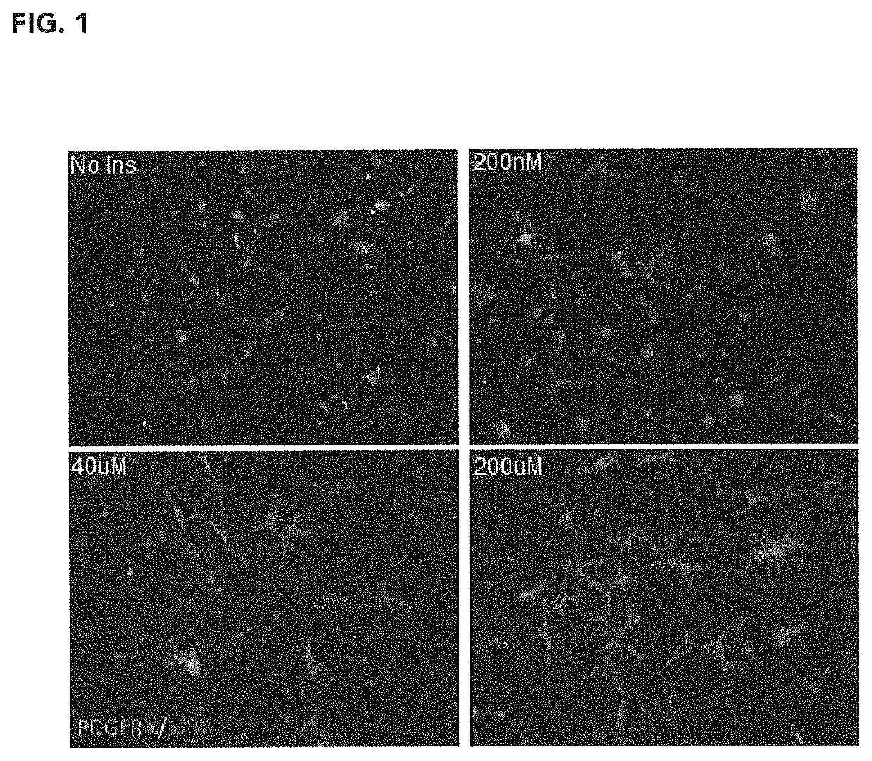 Nutritional compositions containing an elevated level of inositol and uses thereof