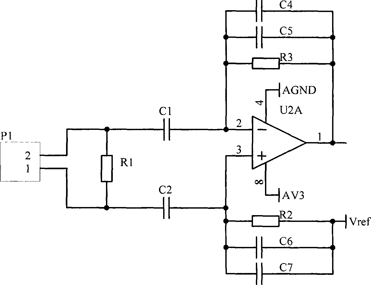 Anti-strong fixed interference digital signal processing system of vortex street flowmeter