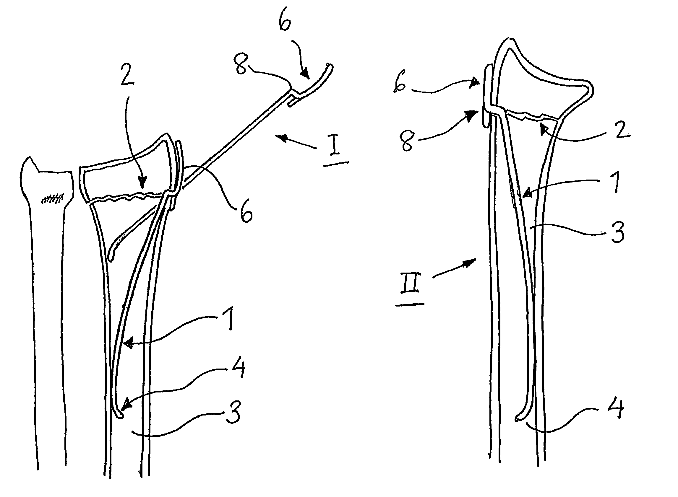 Surgical fixation pin