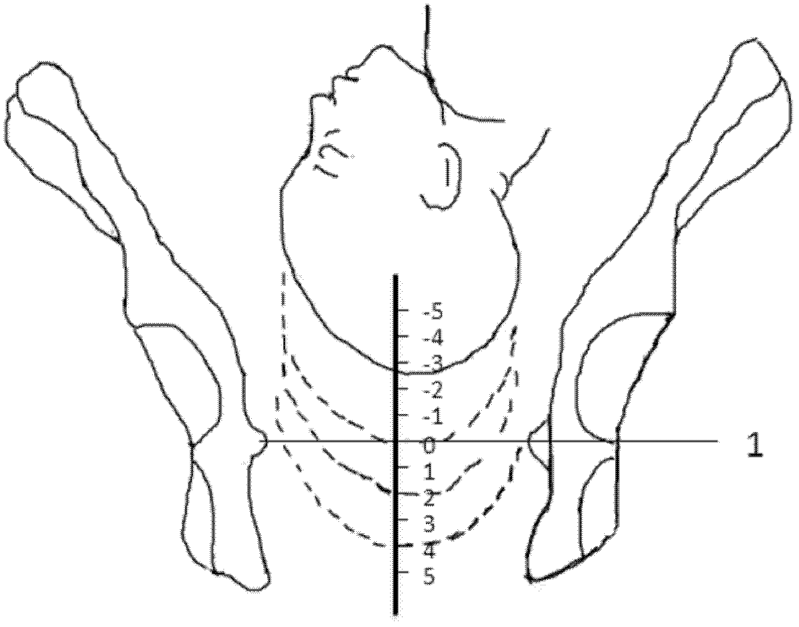 Electronic partogram system based on magnetic field tracing and positioning technology