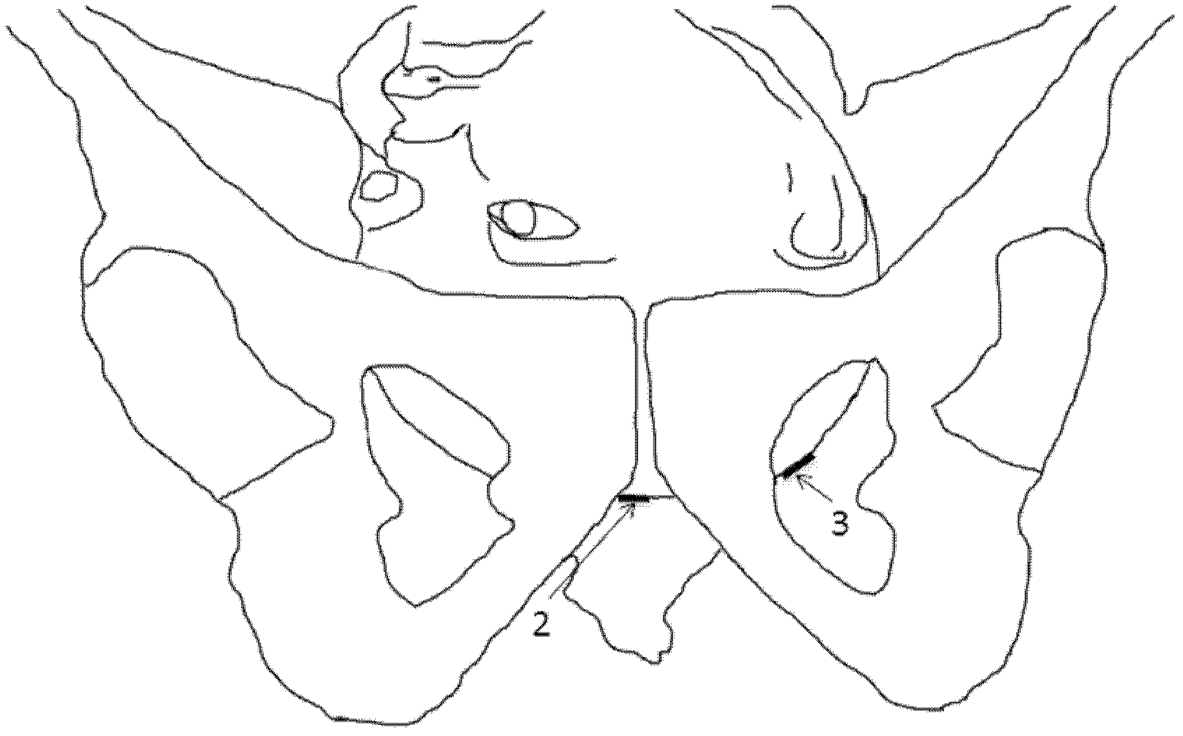 Electronic partogram system based on magnetic field tracing and positioning technology