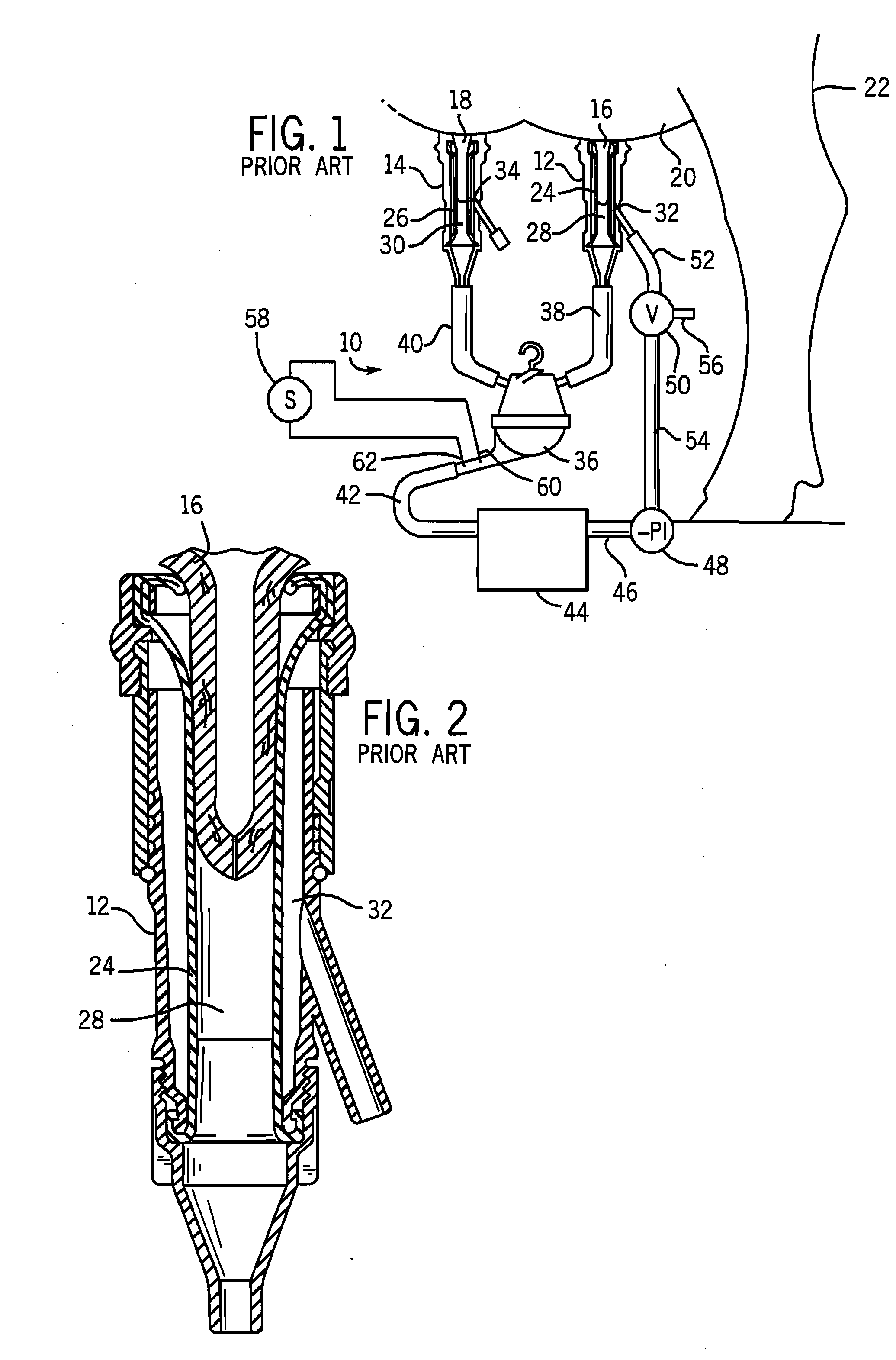 Adaptive Milking System