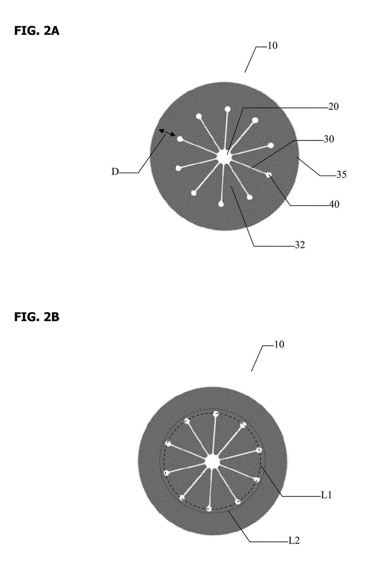 Anastomotic Stapling Reinforcing Buttress and Methods of Deployment