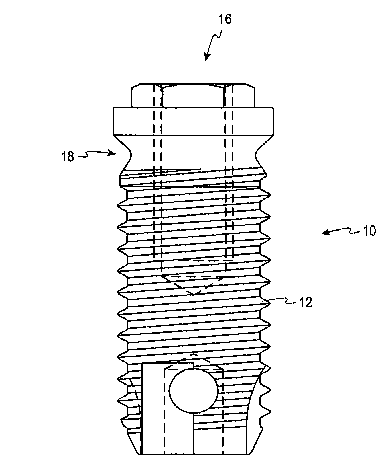 Surface treatment process for implants made of titanium alloy