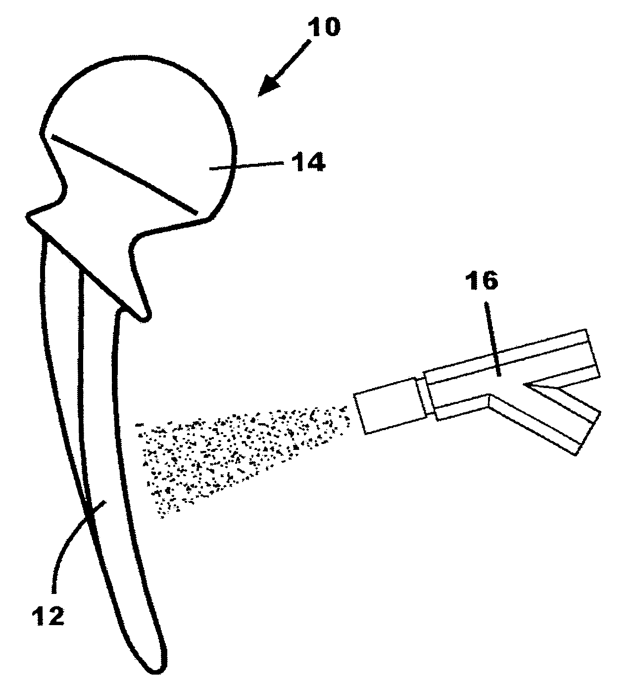 Shot peening of orthopaedic implants for tissue adhesion