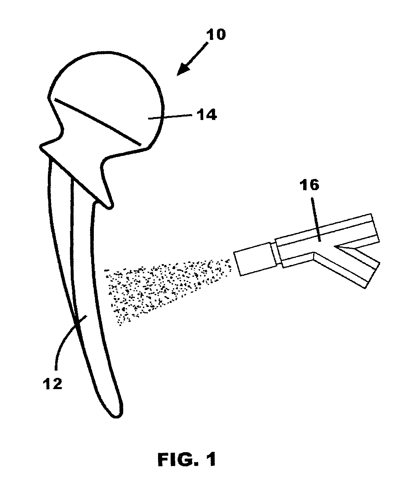 Shot peening of orthopaedic implants for tissue adhesion