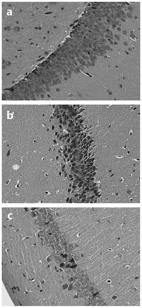 Application of bacillus coagulans JA845 in preparation of medicine for preventing and/or treating Alzheimer's disease