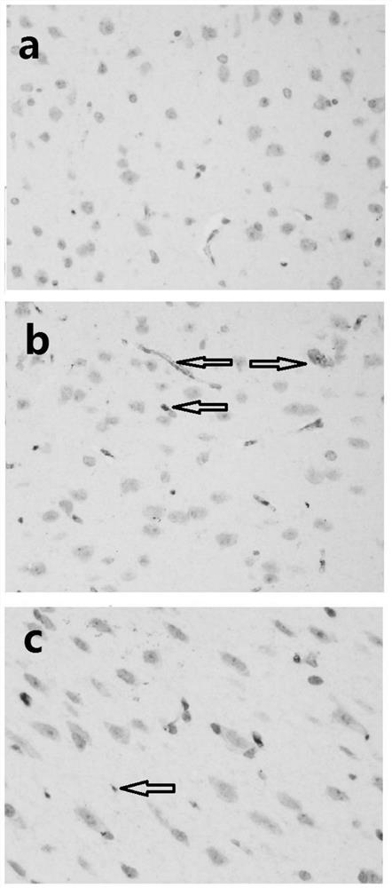 Application of bacillus coagulans JA845 in preparation of medicine for preventing and/or treating Alzheimer's disease