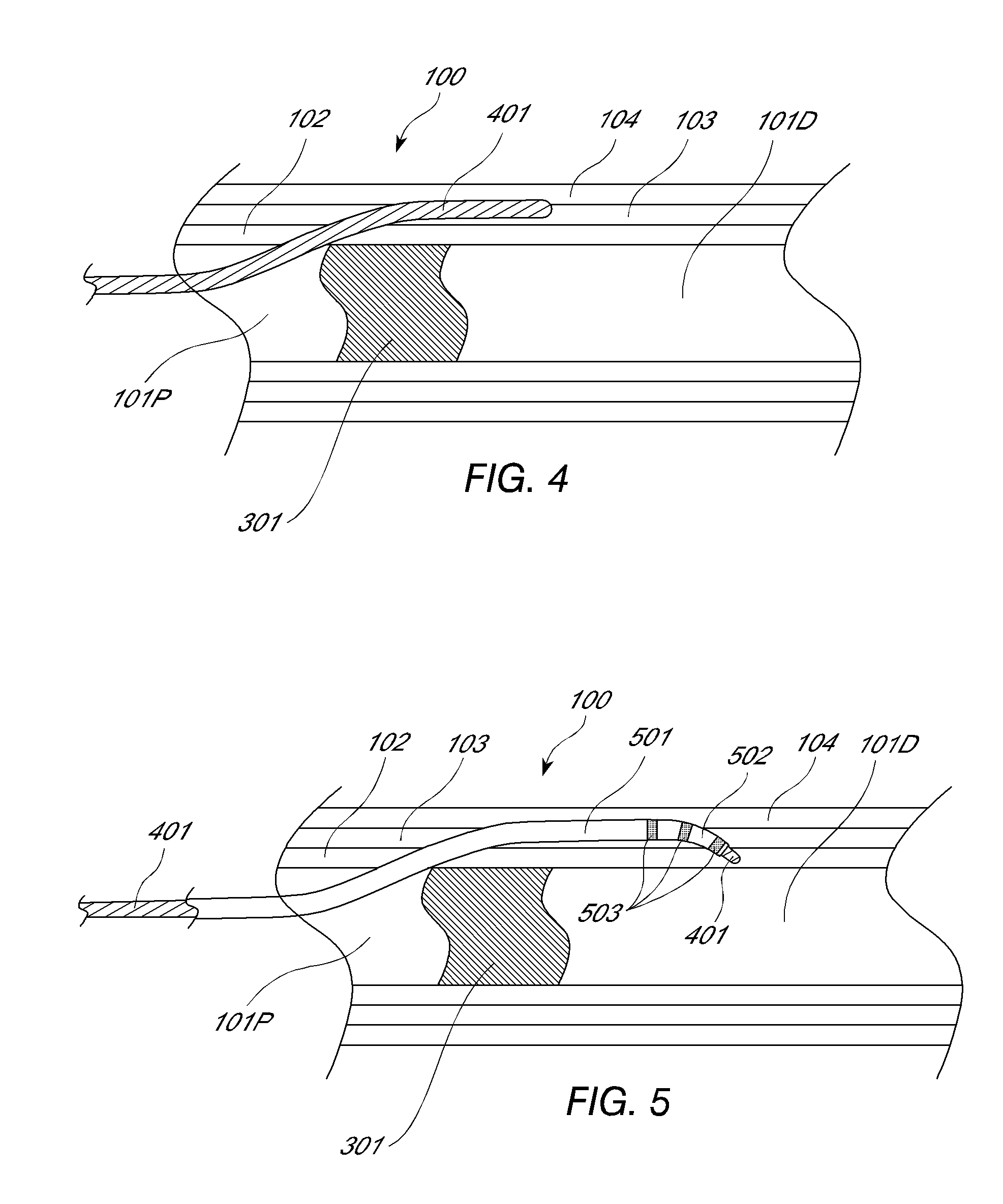 Device and method for vascular re-entry