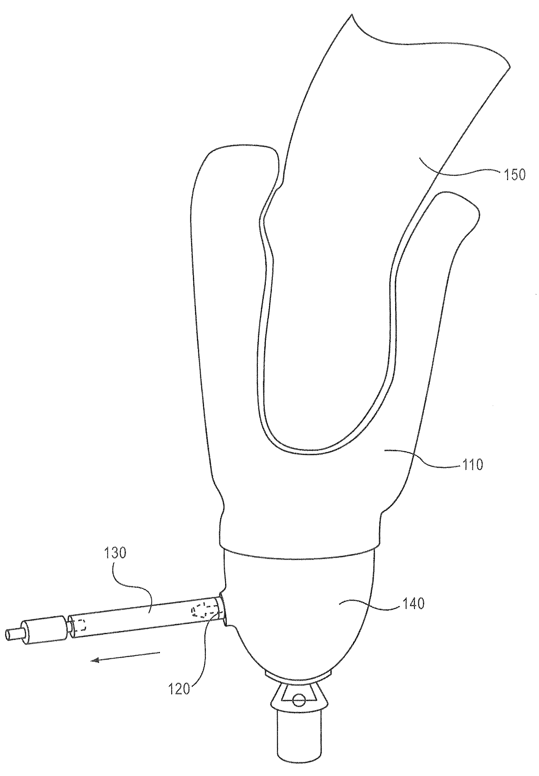 Vacuum based impression and alignment device and method