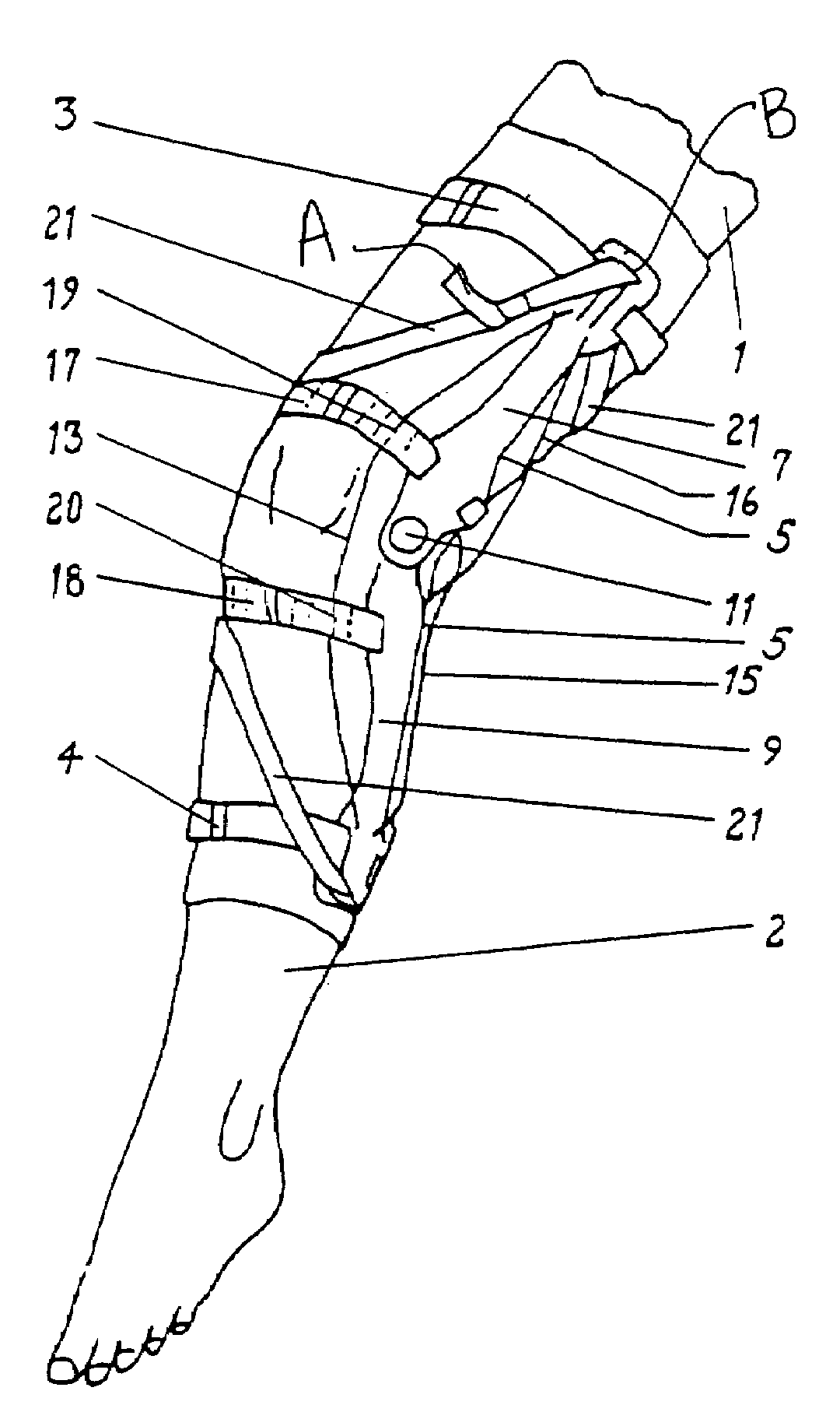 Variably adjustable bi-directional derotation bracing system