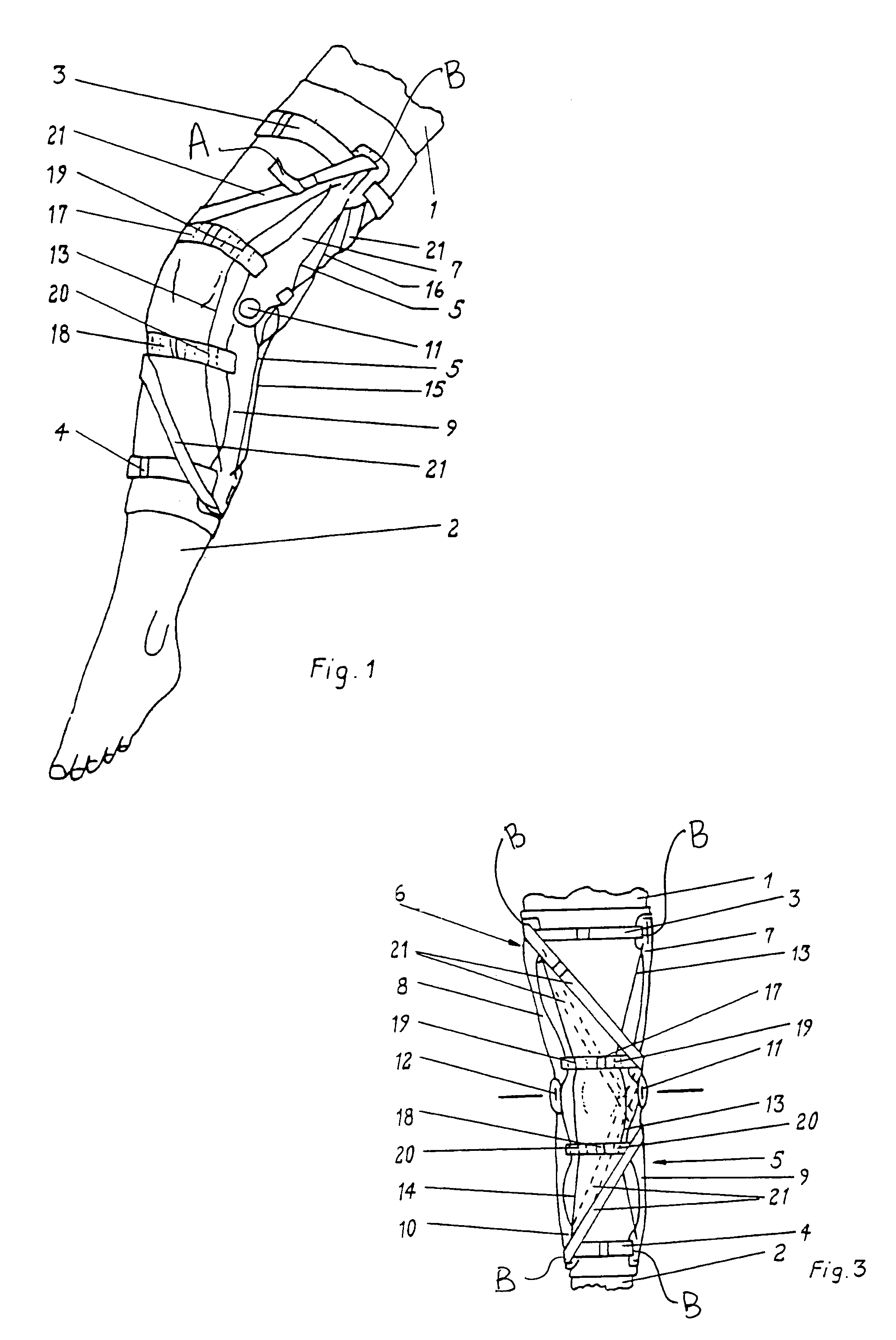 Variably adjustable bi-directional derotation bracing system