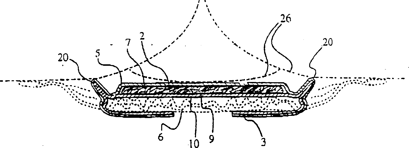 Sanitary absorbent article with positioning tabs incorporating barriers against leakage