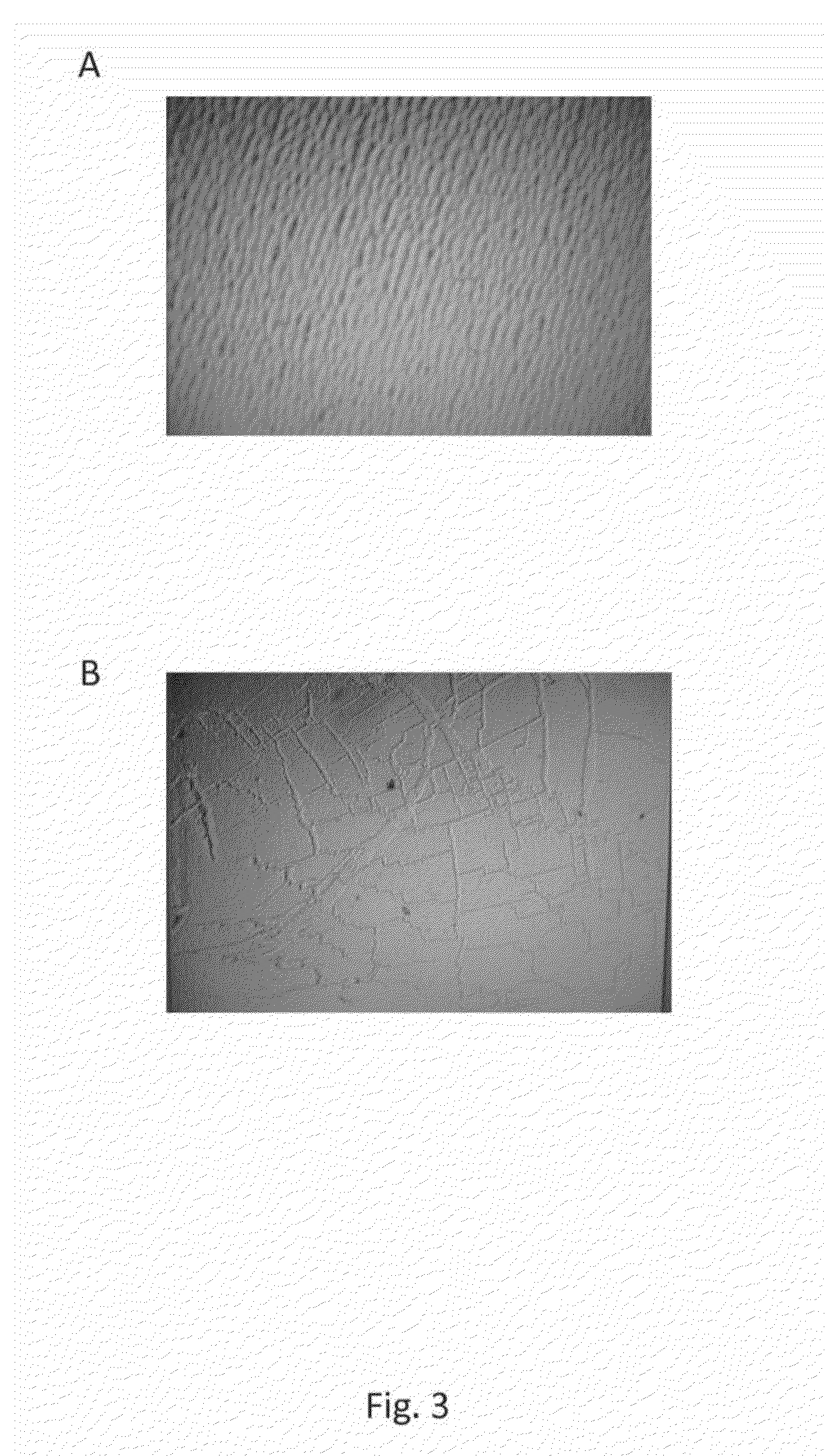 Manganese superoxide dismutase variants and uses thereof