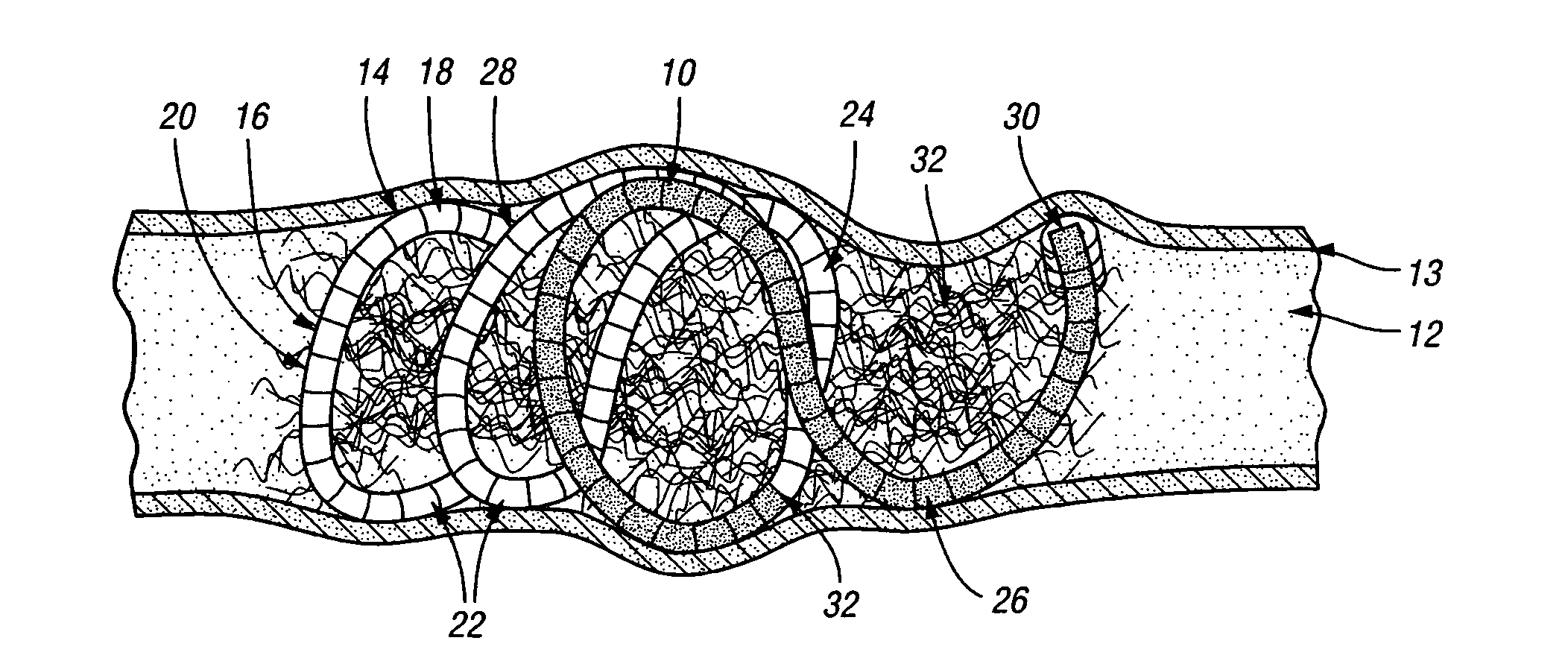 Variable stiffness occluding device