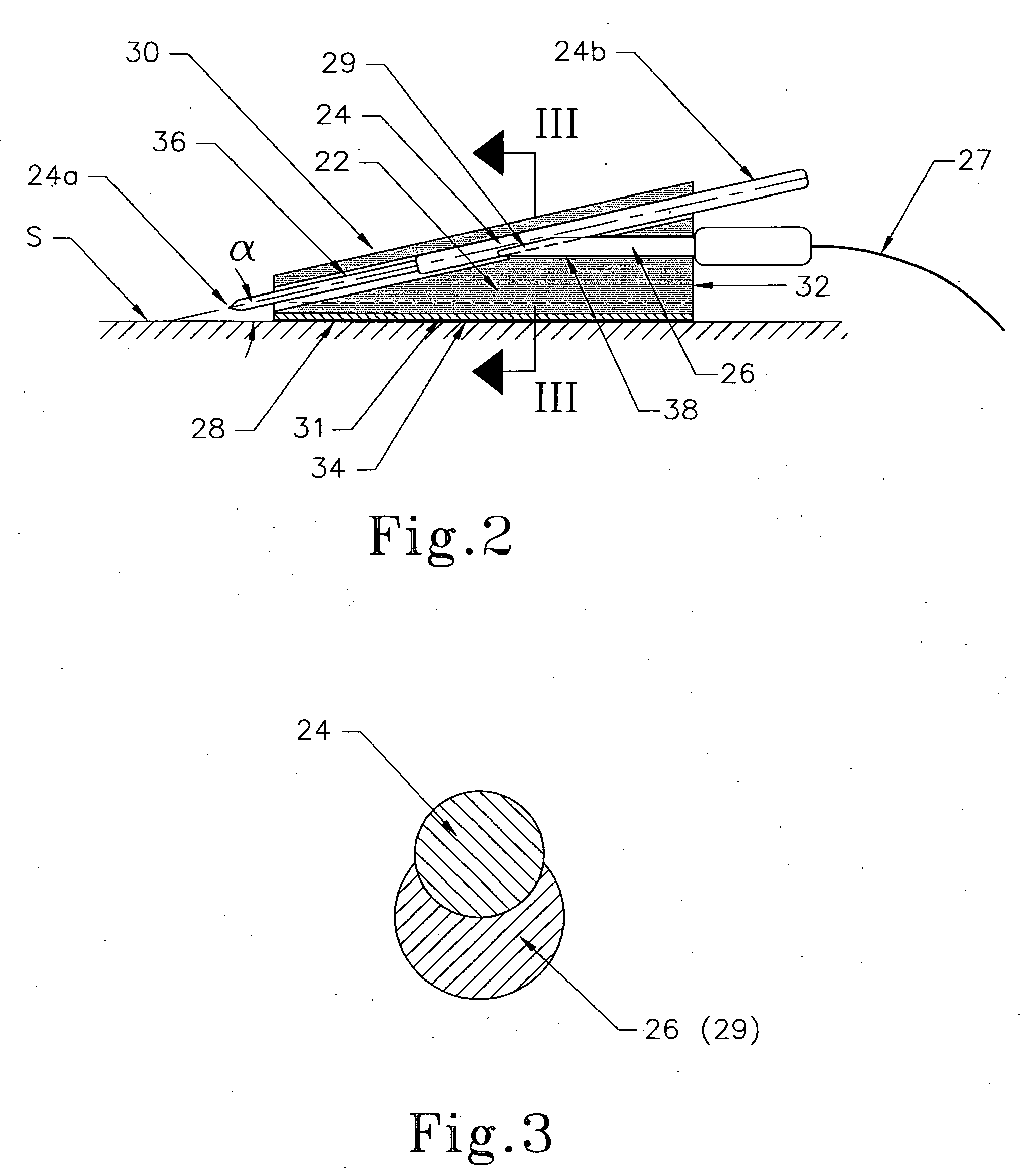 Device for percutaneous nerve stimulation