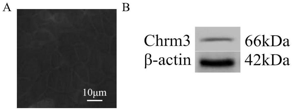 Application of FRT cell strain in preparation of preparation or kit for screening Chrm3 regulator