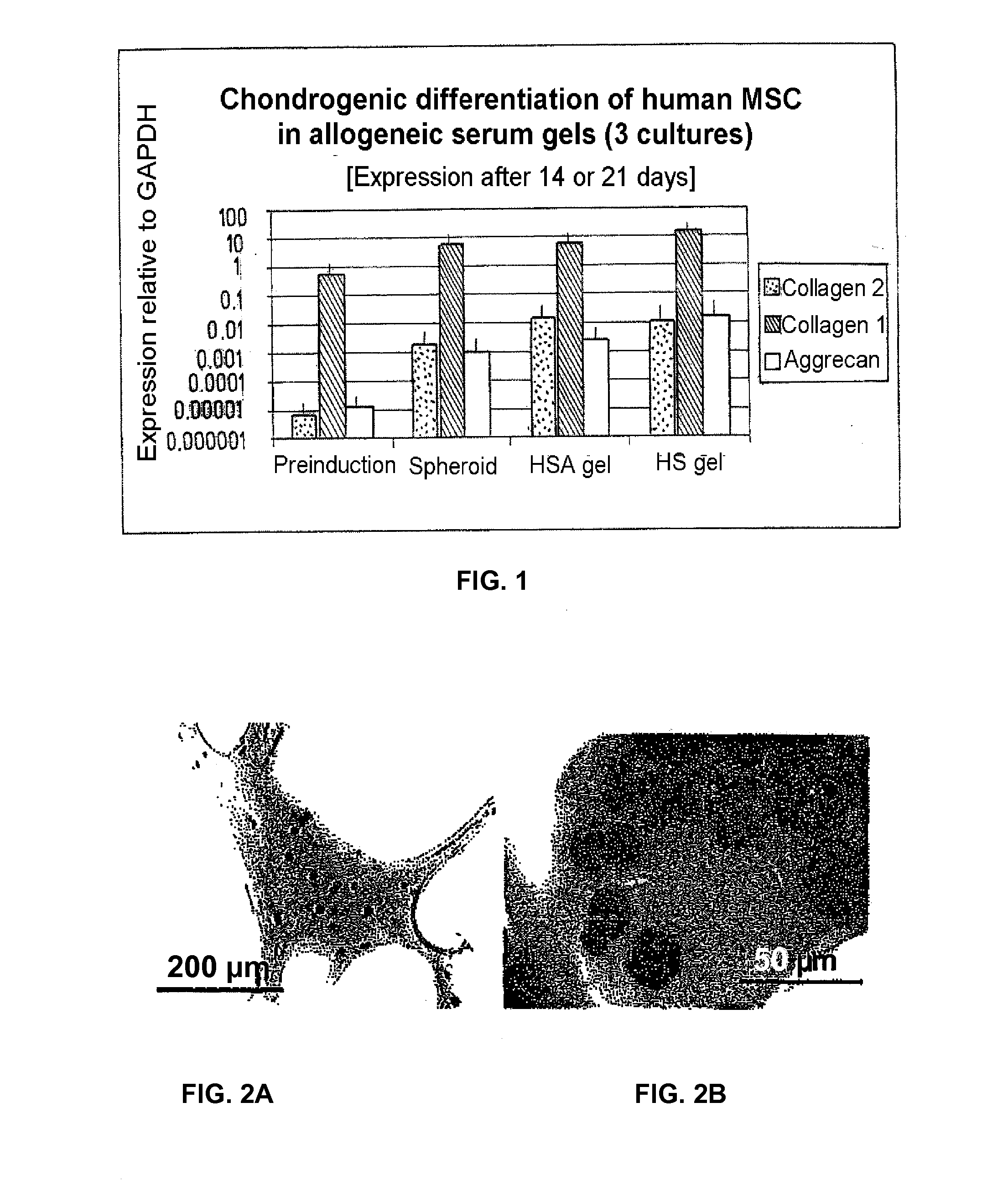 Injectable biocompatible composition