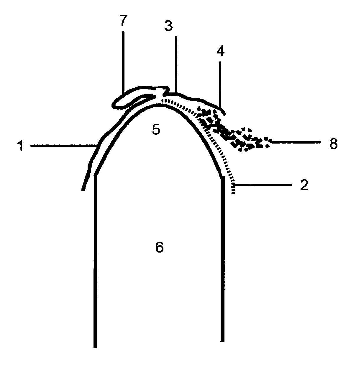 Condom valve