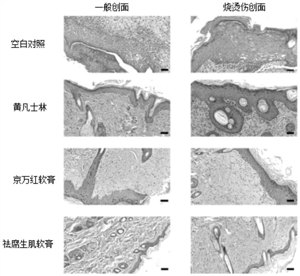 Ointment for removing slough and promoting tissue regeneration, preparation method and application thereof