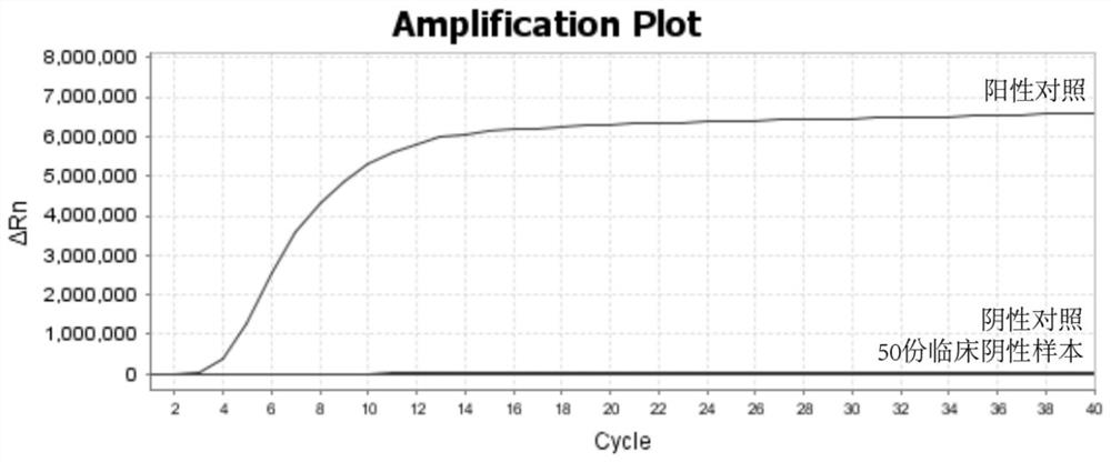 Kit for detecting respiratory syncytial virus and application thereof