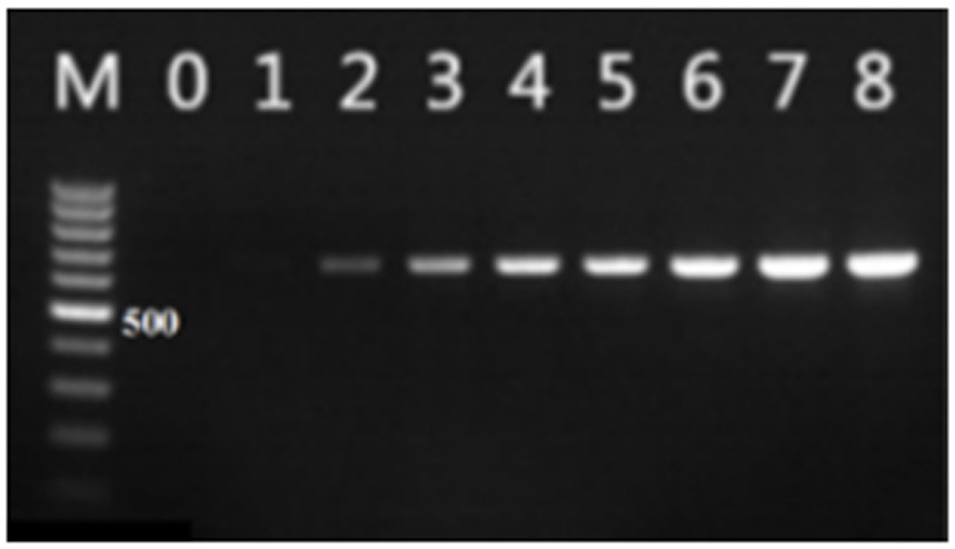 A kind of multiple PCR kit and detection method for transgenic soybean detection