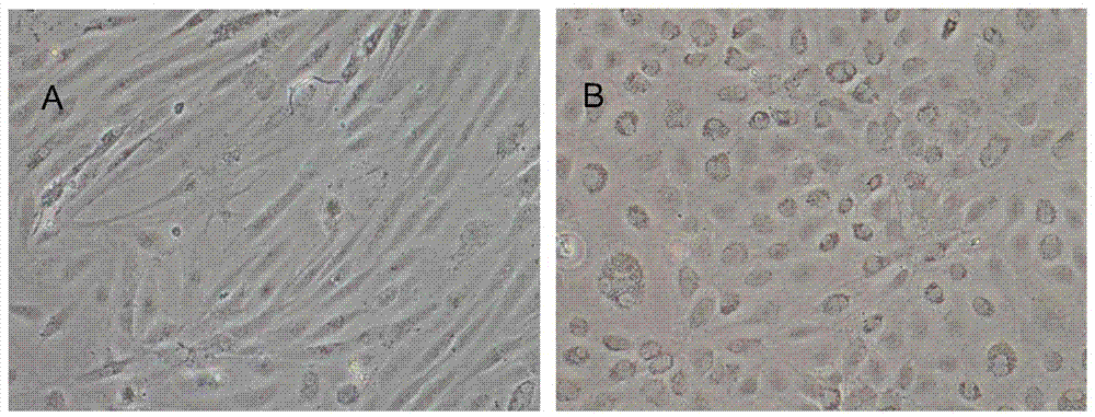 Construction method of bastard halibut brain cell system